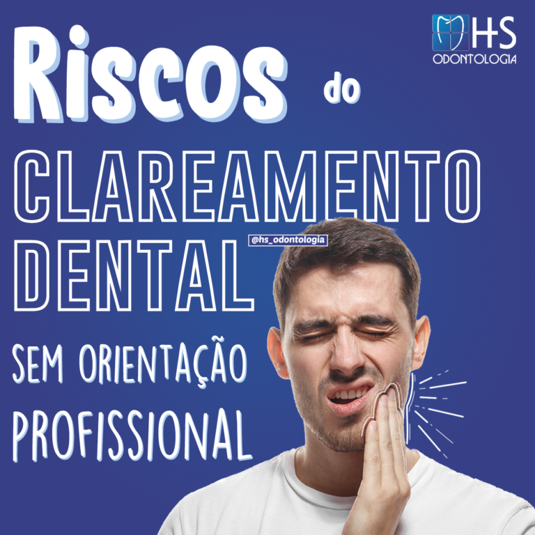 Riscos do Clareamento Dental sem orientação.